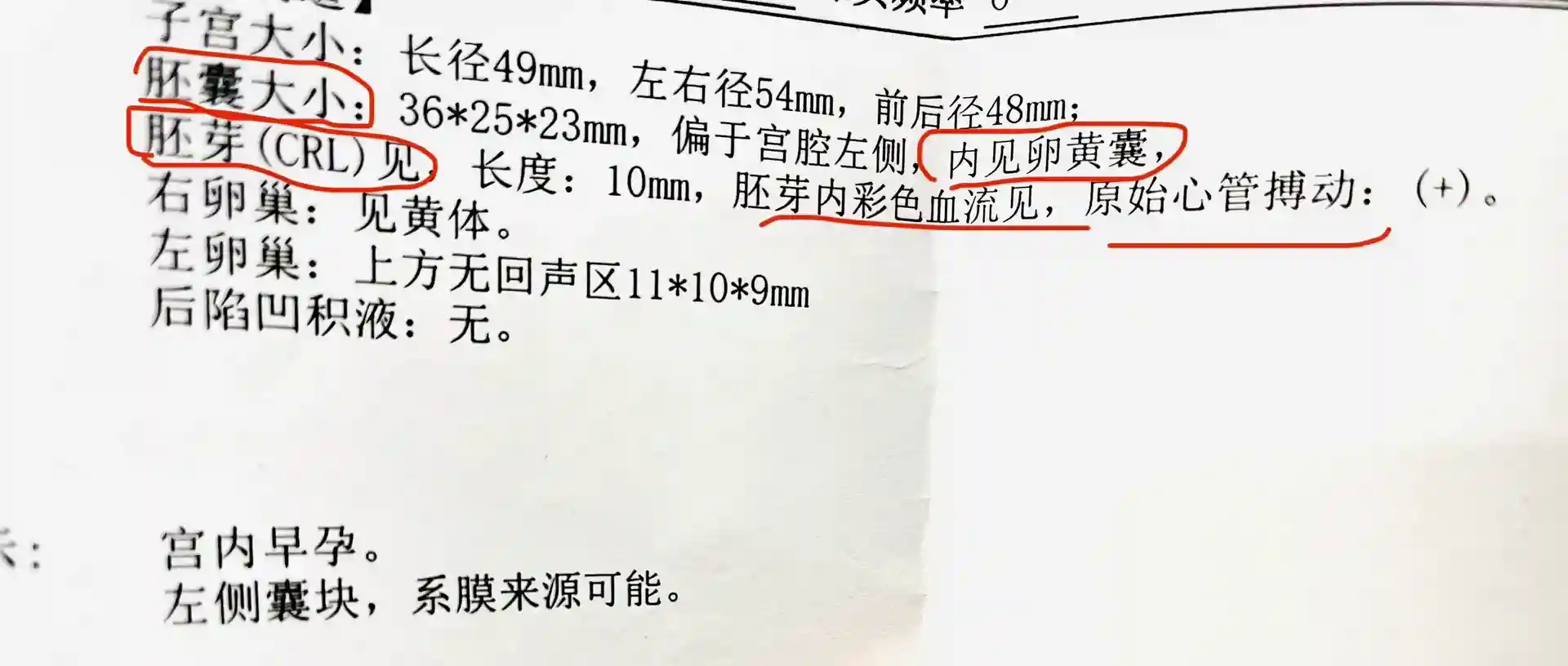 两分钟教你孕早期b超单怎么看