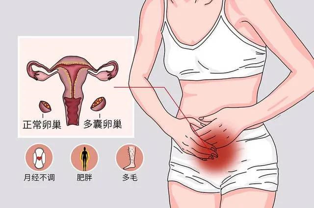 这些女性无缘做试管婴儿!女性在什么情况下不能试管助孕 这些女性无缘做试管婴儿!女性在什么情况下不能试管助孕