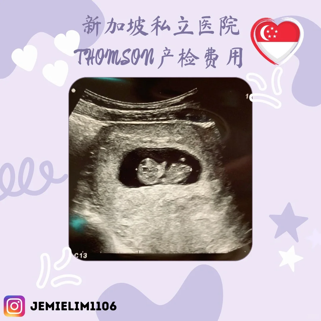 新加坡私立医院Thomson产检费用分享