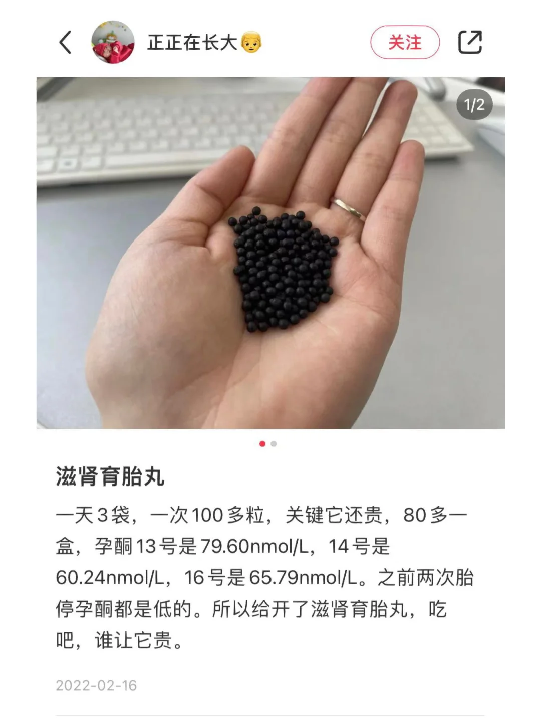 第一次产检 一切正常