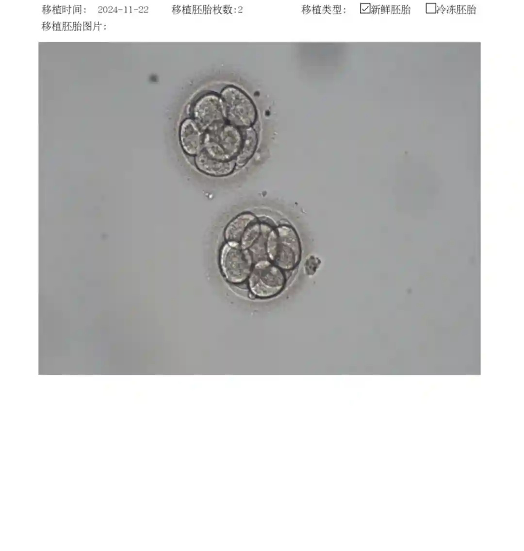 移植2枚8细胞1级鲜胚成功率高吗？