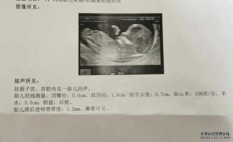 2023泰州供卵试管医院排名前十重磅来袭!附借卵排队时间详情