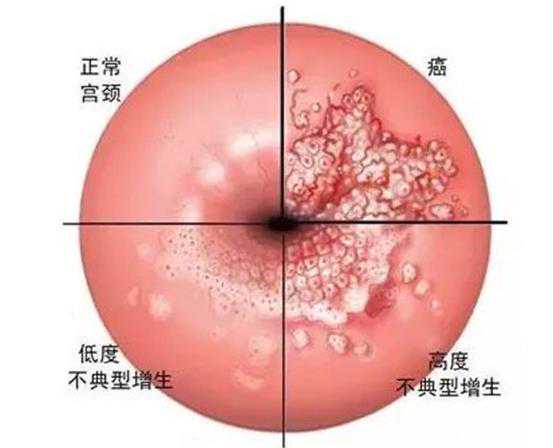 宝鸡供卵试管 宝鸡市妇幼保健院推荐理由 ‘孕妈妈总觉得自己怀的是男孩,怀孕症状又像女孩’