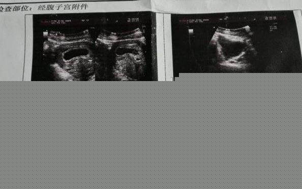 供卵 试管 北京 北京试管私立医院哪一家好? ‘23*10*31孕囊是男还是女’