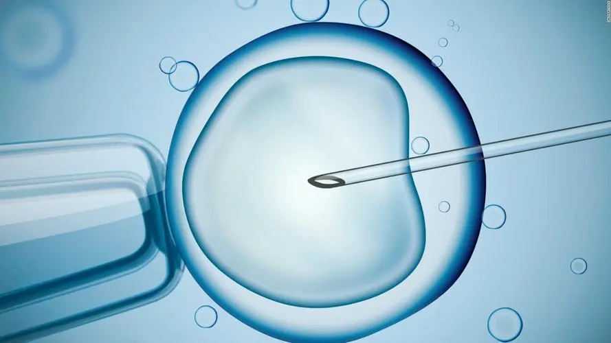 郑州三代试管婴儿电话 2022郑州大学第一附属医院三代试管胚胎筛查要花多长时间?附三代试管流程一览 ‘四个月彩超怎样看男孩女孩图’