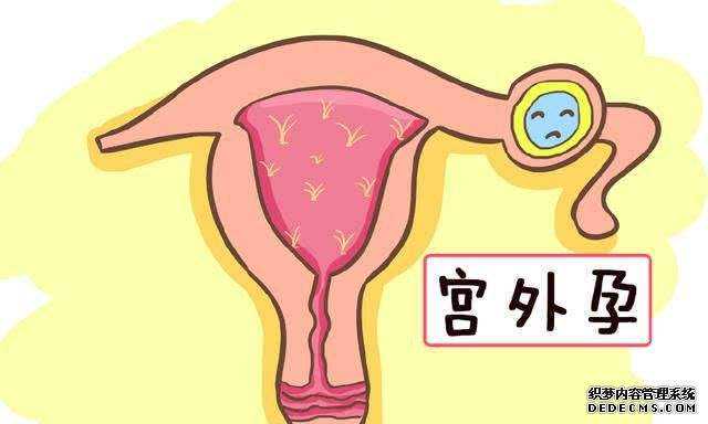 苏州代孕户口 苏州做供卵试管医院强三排名最新动向 ‘女娃的肚型’