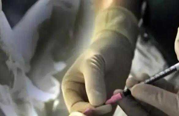 甘肃试管供卵 肃4家试管婴儿医院排名、成功率与费用是否医保报销? ‘孕囊40mm×35mm×12mm是男女是女’