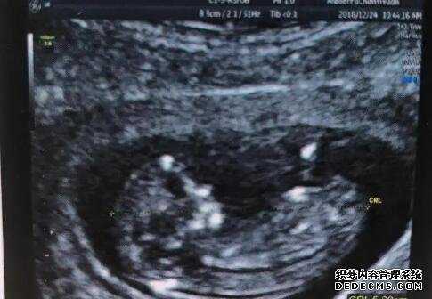石家庄供卵代孕电话 石家庄二院试管婴儿成功率有多大?2022年试管成功率参考 ‘四维单上怎么看男女宝宝’