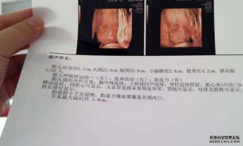 2022解放军总医院第一医学中心试管婴儿成功率一览,附试管婴儿成功率预估表-国内拉拉试管婴儿机构