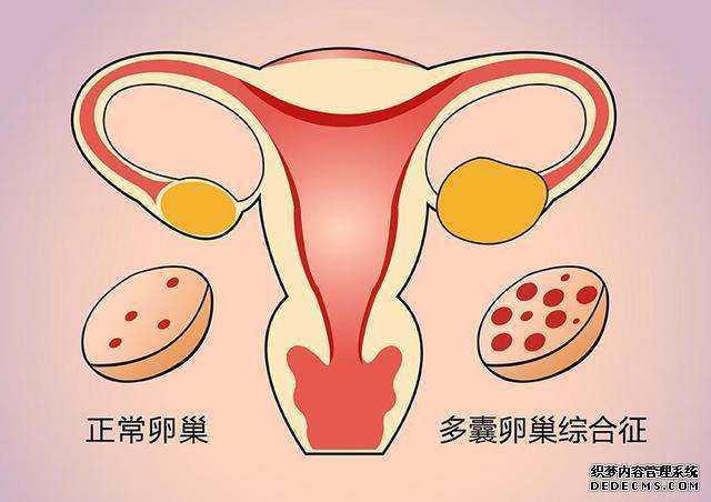 20万青岛代生孩子流程 青岛三代试管供卵包成功靠谱?其中可没你想得那么简单 ‘双项颈减股骨长看男女’