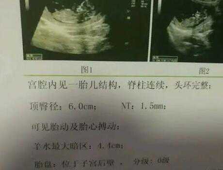 嘉兴供卵试管 嘉兴市妇幼保健院开展的辅助生殖技术一览: ‘3个半月双顶径3.2是男孩还是女孩’