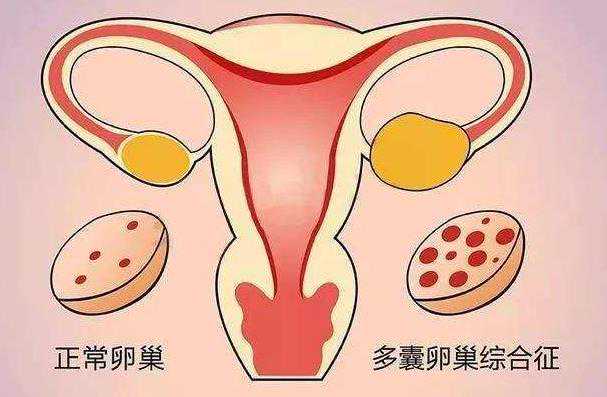 临沂供卵试管 临沂做试管婴儿多少钱 ‘怀女宝的9个症状准到爆’