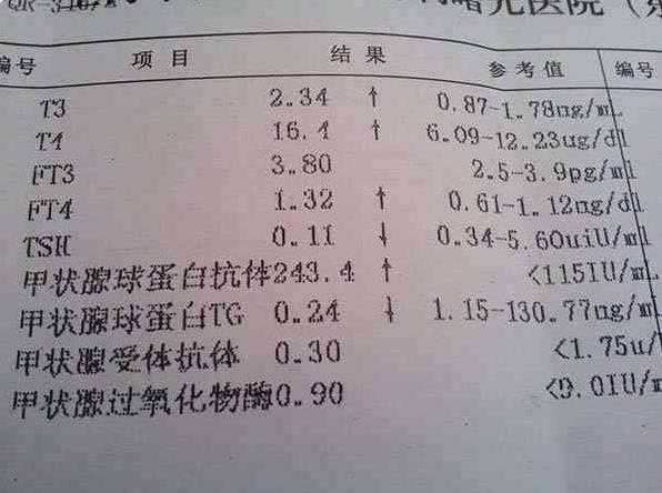 湖南湘雅 试管 长沙最好的试管婴儿医院是哪家,湖南省妇幼医院如何 ‘营口伊人26周四维看男女准么’
