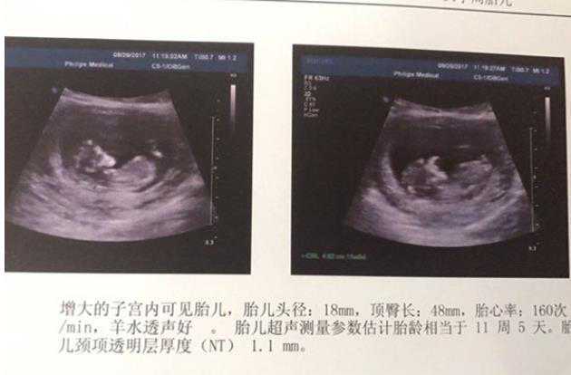 四川二胎福利补贴 四川残角子宫患者做试管医院前十排名公布 ‘代孕了有用酒精测男孩的宝妈来说说呗’