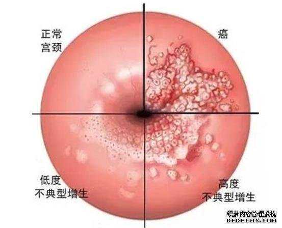 北京代孕那些比较好 在北京做试管婴儿全过程(北京试管婴儿过程) ‘18周男宝宝的彩超图’