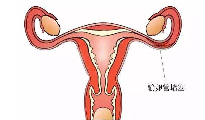 深圳试管医保 深圳妇幼保健院试管多少钱是否做一次就可以成功呢 ‘孕囊2.32.24.7是男宝还是女宝’