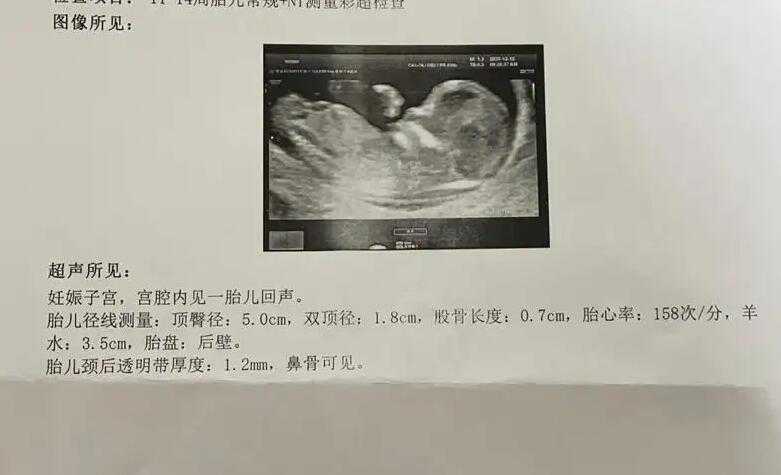 宿州第三代人工受孕流程有哪些特点和优势?,怀孕10天肚子会疼吗?