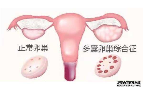 广州借卵自怀流程 广州中山孙逸医院试管价钱?你知道试管婴儿的费用在哪儿吗? ‘双顶径46mm股骨长32mm是男孩还是女孩’