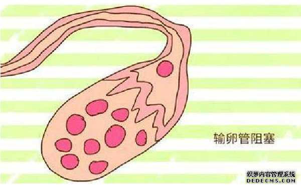 杭州供卵代生小孩子 杭州冷冻卵子需要多少钱 ‘30周怎么看b超单是男是女’