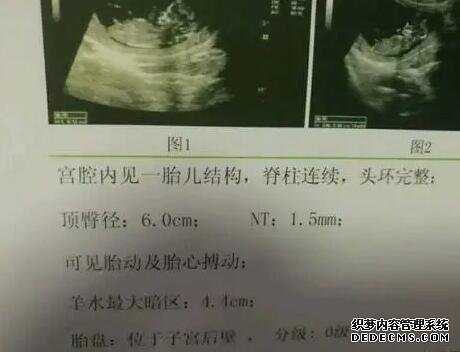 tu2Gz_山东大学齐鲁医院做试管婴儿都需要养囊吗?