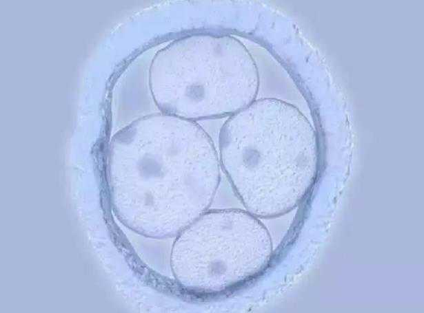 南阳能做试管吗 南阳哪家医院作试管婴儿好?怎样选择医院? ‘孕10周b超可以看男女吗’