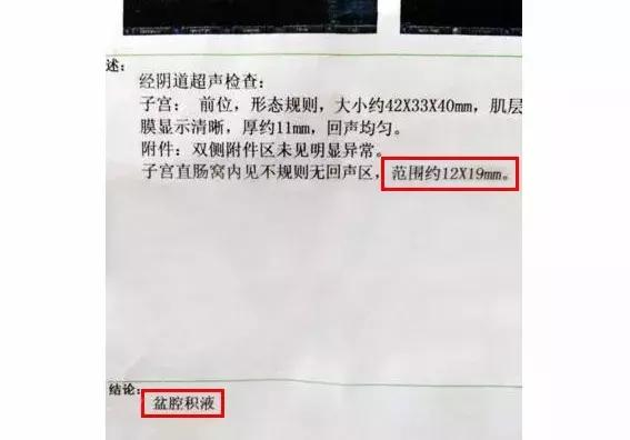 母体在孕期的不同阶段需要多少钙来保证胎儿的正常发育?孕妇在孕期应该如何合理地补钙?