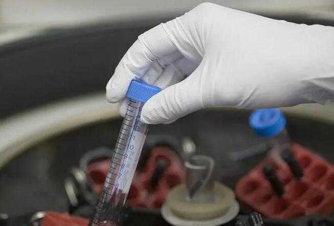 福州代孕步骤 福州市2022年生男孩作为供卵试管的条件分析 ‘营口伊人26周四维看男女准么’